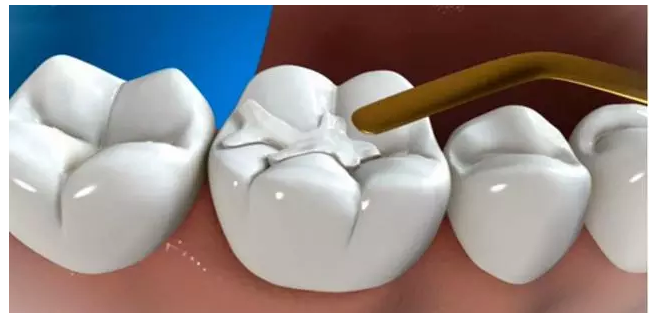 杭州42家口腔医院店通用！99元抢年末家庭看牙年卡套餐！7大护牙项目包含，重视口腔健康！为自己做一次健康的牙齿护理吧！